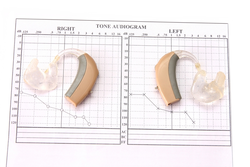 An example of audiogram.